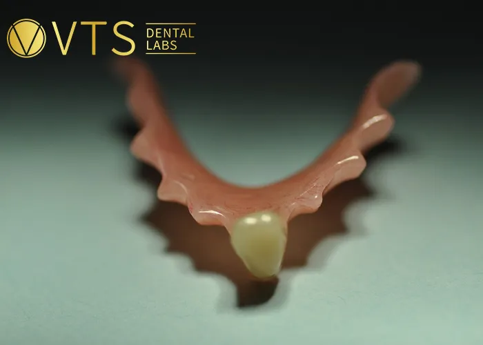 One-Tooth-Denture -The-Optimal-Solution-for-Dentists-and-Patients
