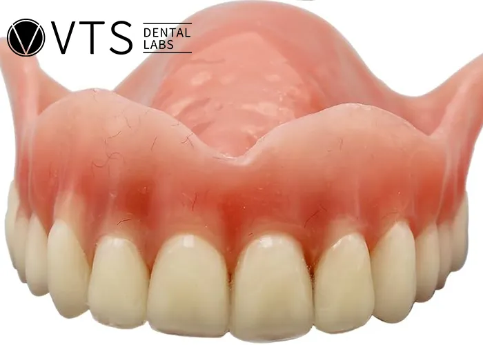 Overdentures-Expert-Tips-for-Optimal-Restoration