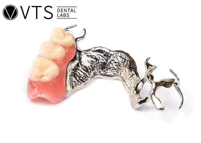 Partial-Dentures-A-Comprehensive-Solution-for-Functionality-and-Aesthetics