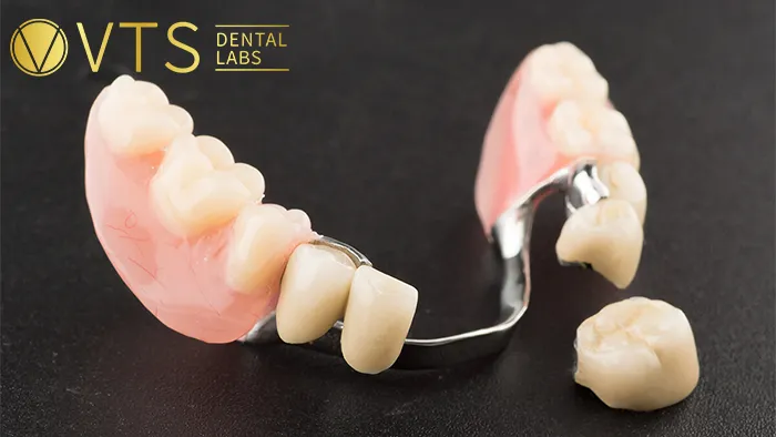 Partial-Dentures-A-Comprehensive-Solution-for-Functionality-and-Aesthetics