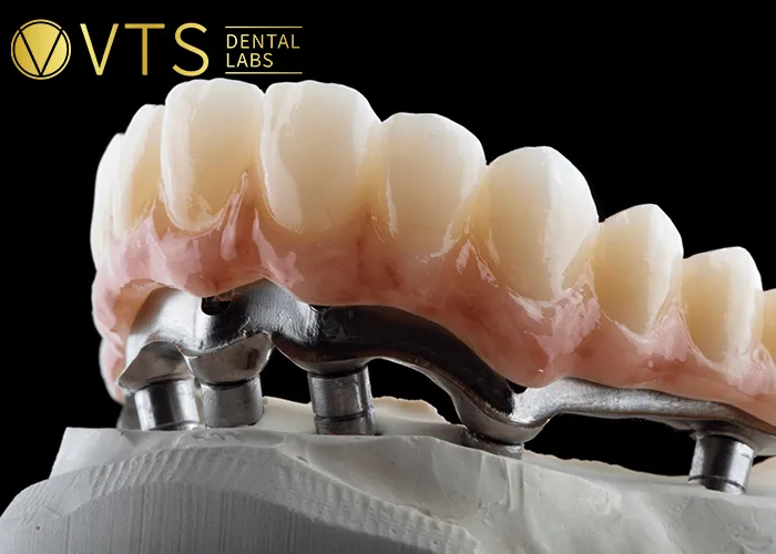 Removable-Dentures-vs-Fixed-Critical-Benefits-True-Costs-and-Smart-Selection-Guide