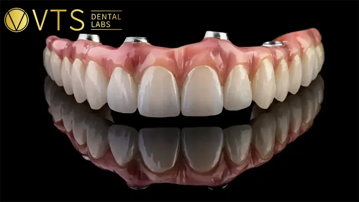 All-On-4-Dental-Implant-All-the-Essential-information-You-need