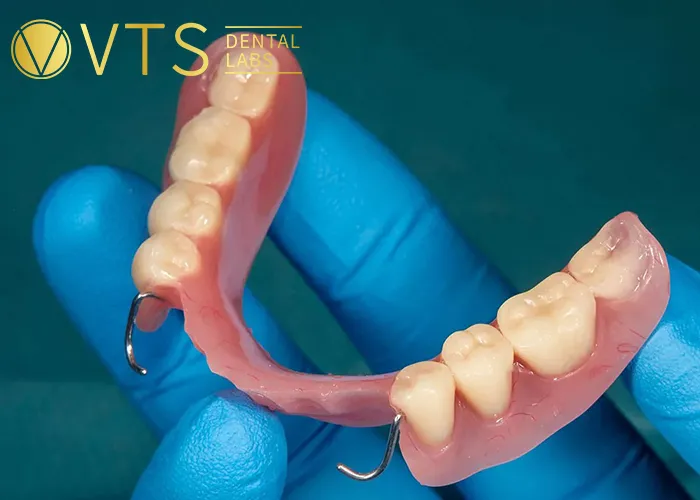 Ultimate-Guide-to-Removable-Partial-Dentures-Everything-Dentists-Must-Know-About-Fabrication-and-Materials