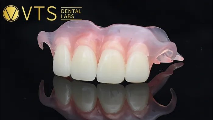 Ultimate-Guide-to-Removable-Partial-Dentures-Everything-Dentists-Must-Know-About-Fabrication-and-Materials
