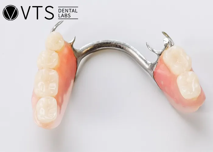 Ultimate-Guide-to-Removable-Partial-Dentures-Everything-Dentists-Must-Know-About-Fabrication-and-Materials
