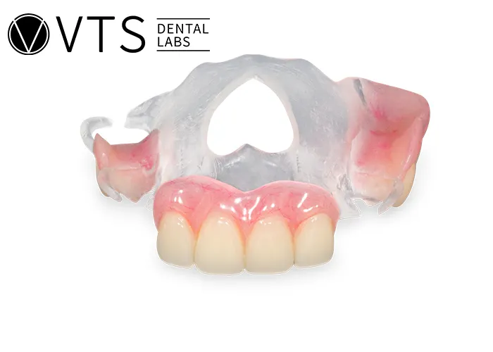 Ultimate-Guide-to-Removable-Partial-Dentures-Everything-Dentists-Must-Know-About-Fabrication-and-Materials