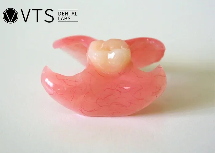 Discover-the-Power-of-Single-Tooth-Dentures-Key-Benefits -and-Lab-Selection-Guide