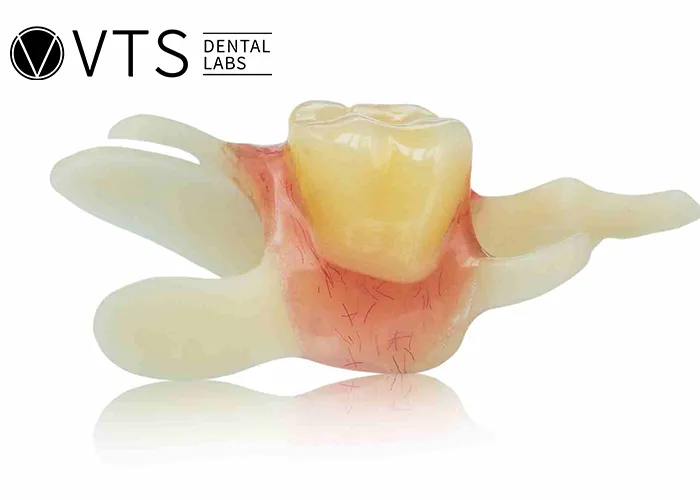 Discover-the-Power-of-Single-Tooth-Dentures-Key-Benefits -and-Lab-Selection-Guide