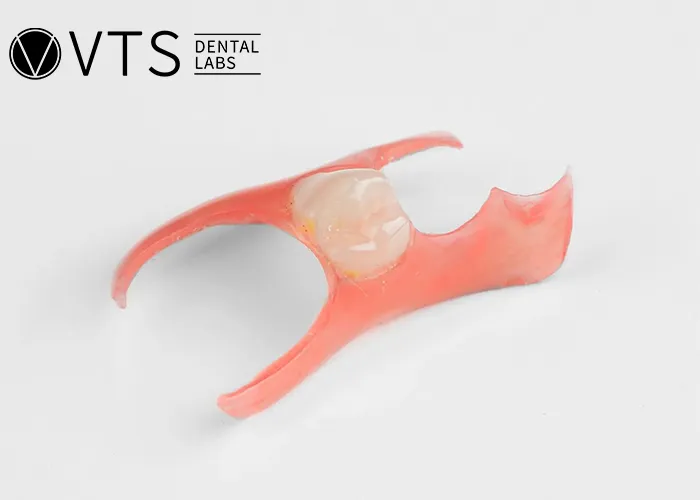 Discover-the-Power-of-Single-Tooth-Dentures-Key-Benefits -and-Lab-Selection-Guide